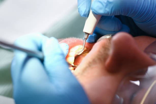 Best Emergency Dental Care for Broken or Chipped Teeth in Stanfield, OR